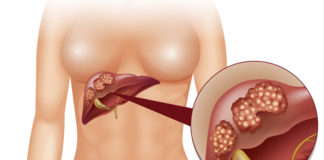 13 Shocking Signs You Need To Change Your Diet Fast