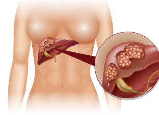 13 Shocking Signs You Need To Change Your Diet Fast