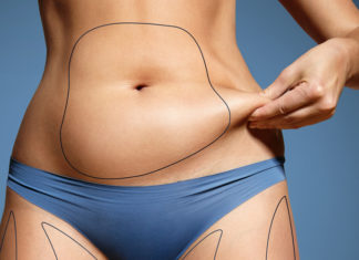 16 Reasons You Can’t Get A Flat Tummy